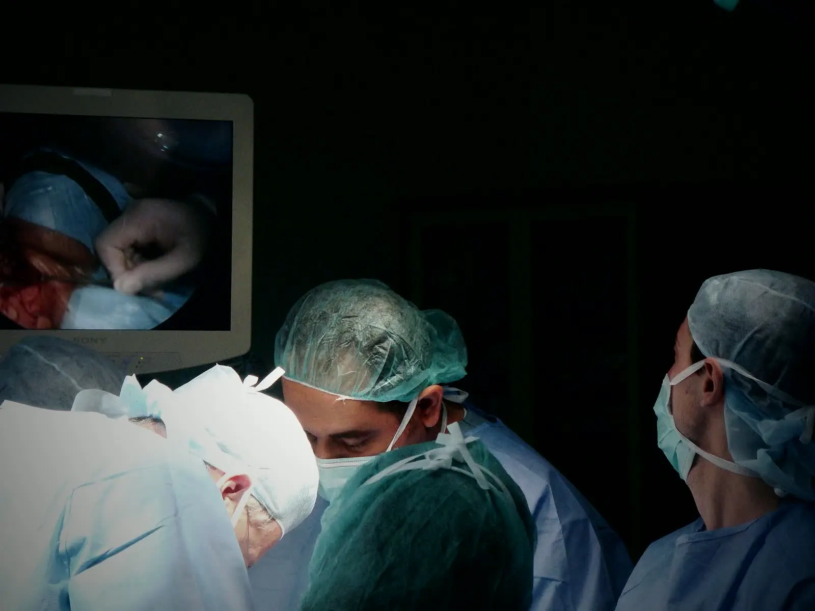 Surgeons in caps and masks watch a monitor above the operating table